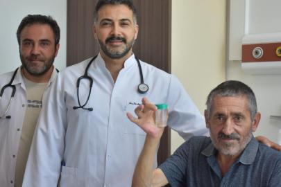 Nefes darlığı yaşayan hastanın akciğerinden sarımsak çıktı